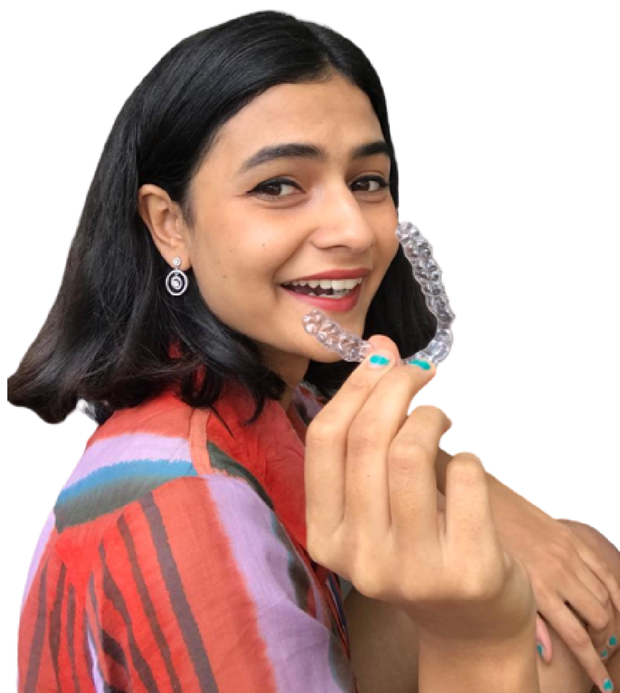 Crowded teeth