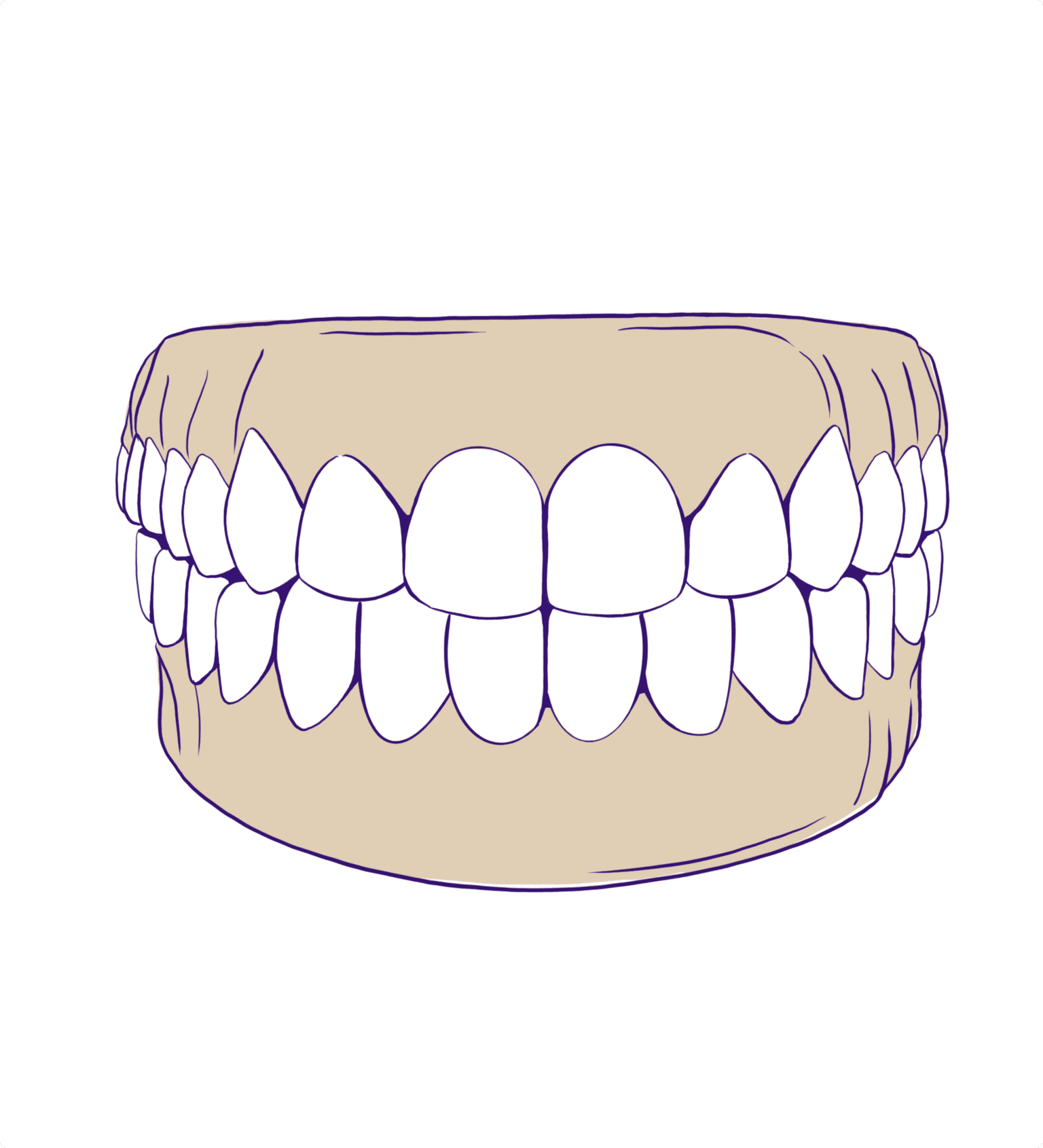 Dentures