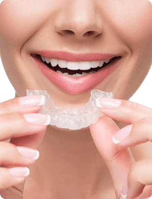 Aligners