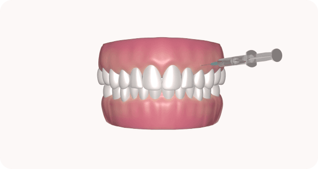 local anaesthesia & tooth preparation