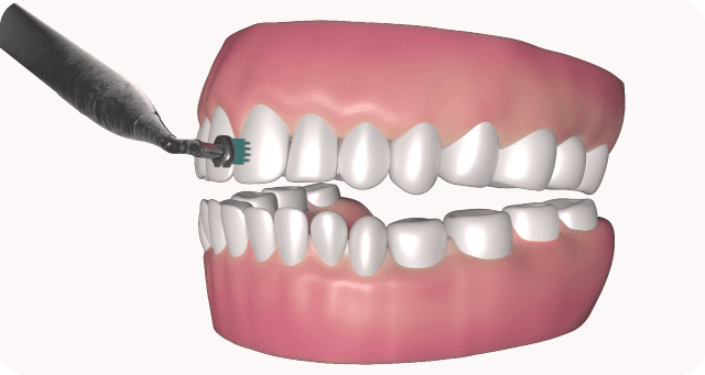 flushes after treatment