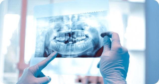 diagnosis & treatment plan for veneer