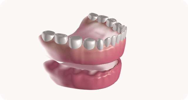 denture set delivery